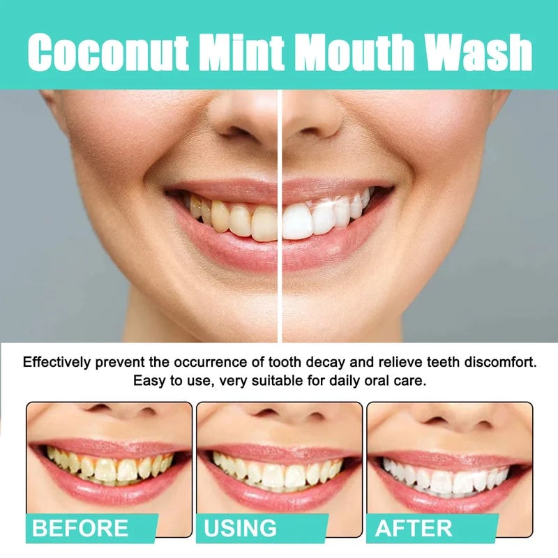 UltraBright Teeth Mouthwash