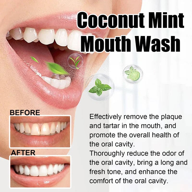 UltraBright Teeth Mouthwash